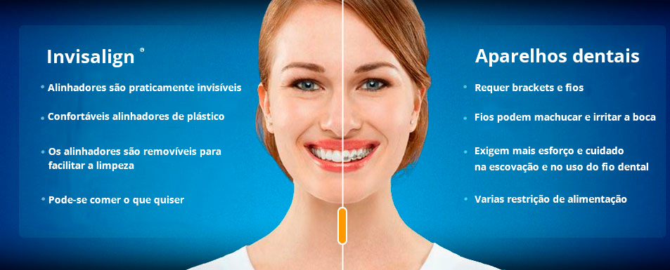 Invisalign - Smile Clínica Odontológica